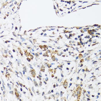 DHRS2 / HEP27 Antibody