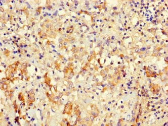 ICT1 / DS1 Antibody