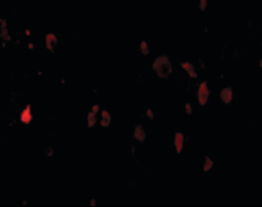 PD-L2 / PDCD1LG2 / CD273 Antibody