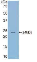 SERPINA6 / CBG Antibody (aa57-256, APC)