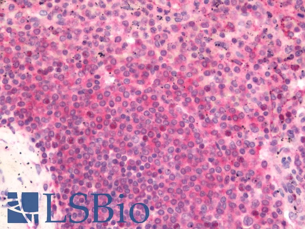 IHC-plus™ Polyclonal Rabbit anti-Human TRPM2 Antibody (aa1200-1250, IHC, WB)