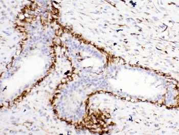 Polyclonal Rabbit anti-Human BCL2L1 / BCL-XL Antibody (IHC, WB)