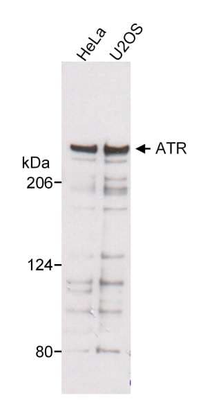 Polyclonal Rabbit anti-Human ATR Antibody (aa400-450, WB)