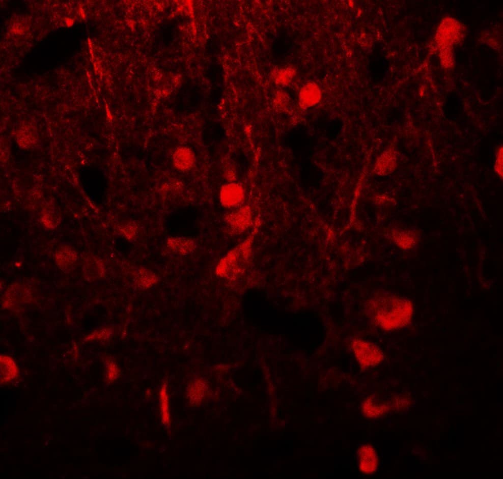 Polyclonal Rabbit anti-Human Alpha Tubulin Antibody (IHC, IF, WB)