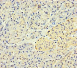 SLC25A35 Antibody