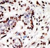 KMT2A / MLL Antibody (aa3879-3908)