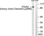 IHC-plus™ Polyclonal Rabbit anti-Human ITGAV/Integrin Alpha V/CD51 Antibody (aa840-889, IHC, WB)