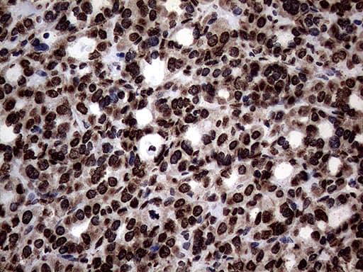 SH3BGRL Antibody (clone OTI8F7)