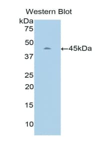 TNNC2 Antibody (aa2-160, FITC)