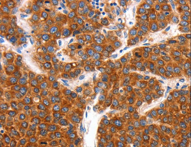 KCNC2 / Kv3.2 Antibody