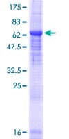 Human BTBD8 Protein (Recombinant GST)