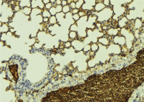 KCNQ1 / KVLQT1 Antibody