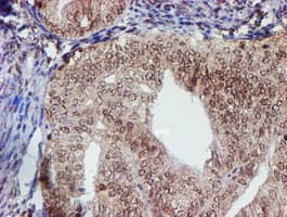 CYP17 / CYP17A1 Antibody (clone OTI3F11)