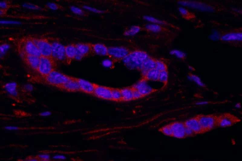 RPS6KA3 / RSK2 Antibody (aa1-50)