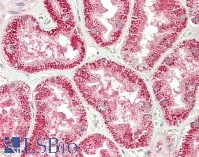 IHC-plus™ SERPINA6 / CBG Antibody