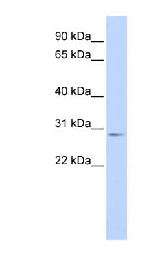 Polyclonal Rabbit anti-Human MYF6 / MRF4 Antibody (aa144-193, WB)