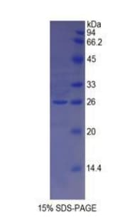 Rat HAVCR1 / KIM-1 Protein (Recombinant His)