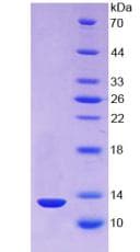 Human TXN / Thioredoxin / TRX Protein (Recombinant His)