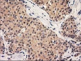 GRHPR / Glyoxylate Reductase Antibody (clone OTI1H8, Carrier-free)