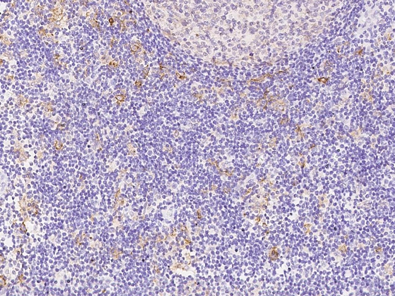 Polyclonal Rabbit anti-Human HLA-DQA1 Antibody (IHC)
