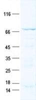 Human NOL5A / NOP56 Protein (Recombinant His, N-Terminal)
