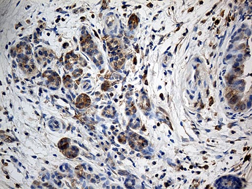 Monoclonal Mouse anti-Human GIPC1 / GIPC Antibody (clone OTI5C10, IHC, WB)