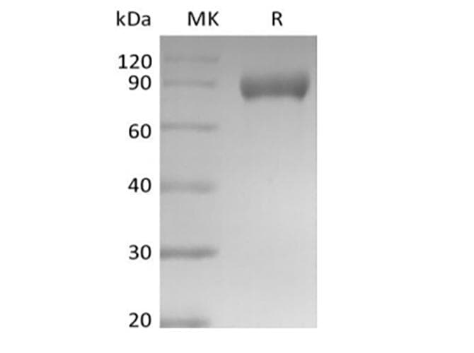 Mouse Siglece Protein (Recombinant Fc, C-terminus)