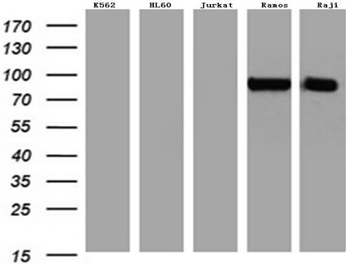 MME / CD10 Antibody (aa411-750, clone UMAB236)