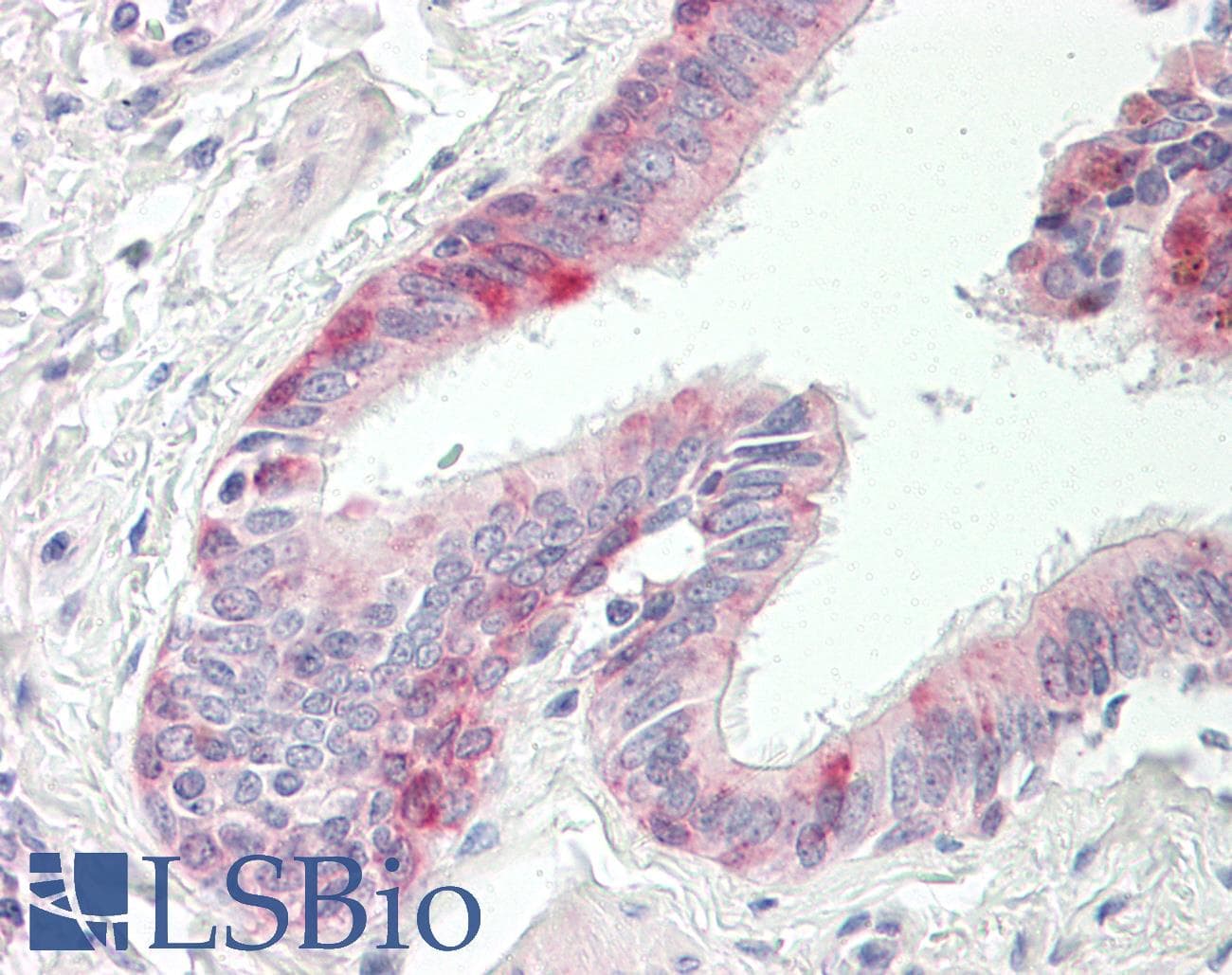 IHC-plus™ Polyclonal Rabbit anti-Human API5 Antibody (aa421-470, IHC, WB)