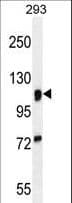 MAN2A1 / Mannosidase II Antibody (aa456-482)