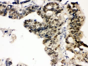 Polyclonal Rabbit anti-Human PTPN2 / TC-PTP Antibody (IHC, WB)