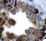 Monoclonal Mouse anti-Human TAG-72 Antibody (Ready-to-Use, IHC)