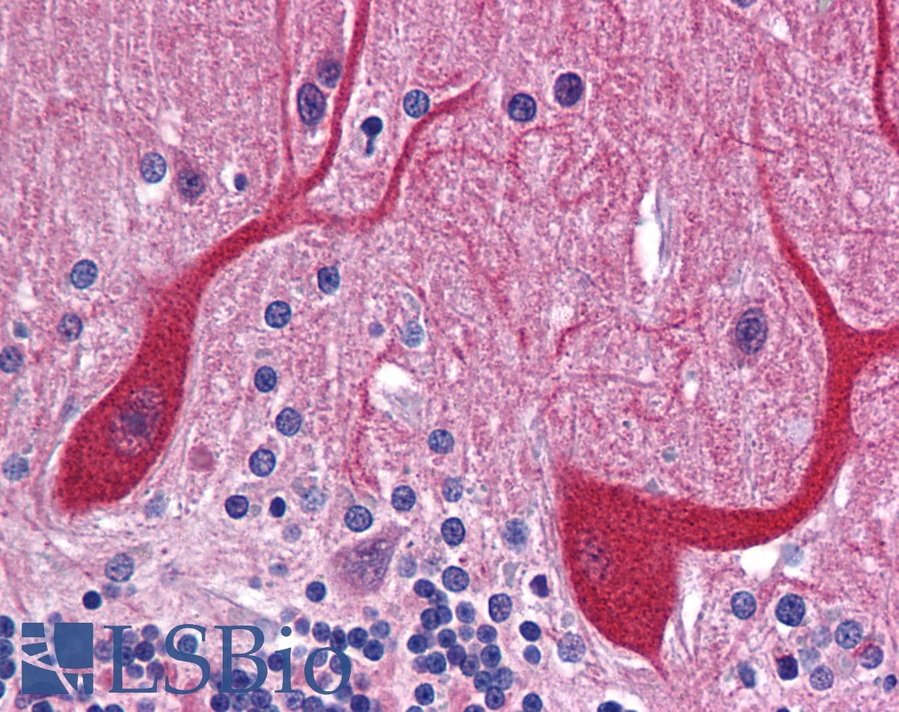IHC-plus™ PKDCC / SGK493 Antibody