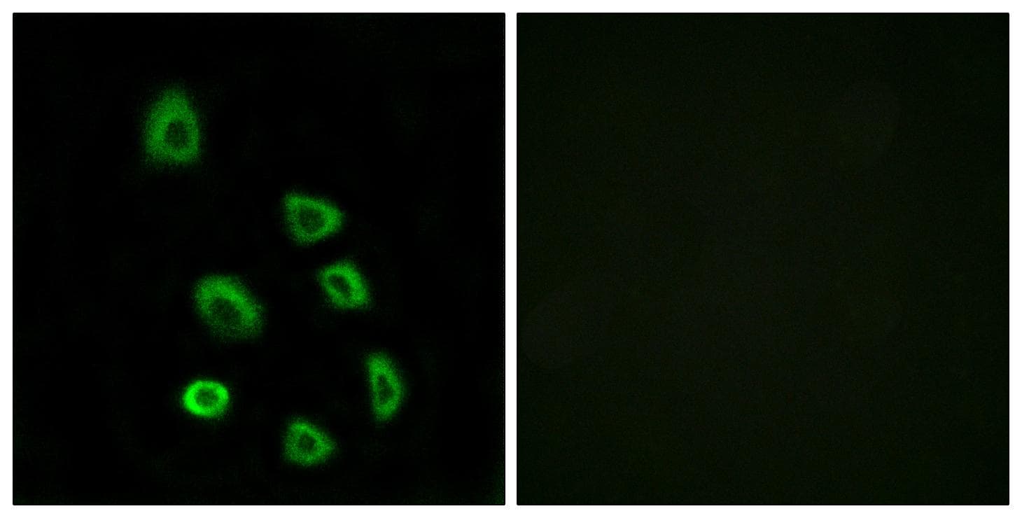OR5K1 Antibody