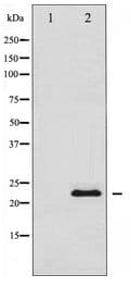 TIMP1 Antibody