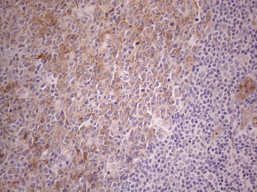 CAMK2B / CaMKII Beta Antibody (aa311-385, clone OTI8D9)