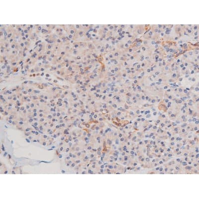 ADD1 / Adducin Alpha Antibody (phospho-Ser726)