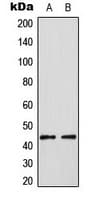 ELK3 / NET Antibody (phospho-Ser357)