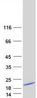 Human CALCA Protein (Recombinant Myc-DDK (Flag))
