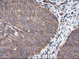 HARS2 Antibody (clone OTI3F1)
