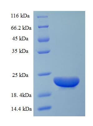Bovine CCL20 / MIP-3-Alpha Protein (Recombinant His-SUMO)