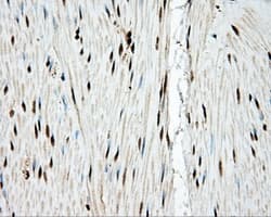 Monoclonal Mouse anti-Human TLDC1 / KIAA1609 Antibody (clone OTI5D9, IHC, IF, WB)