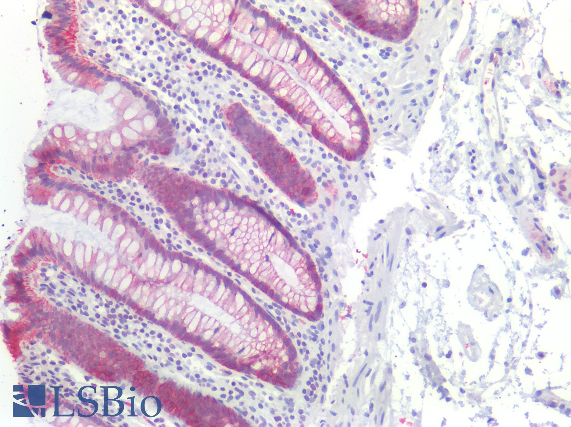 PathPlus™ CDH1 / E Cadherin Antibody (C-Terminus)