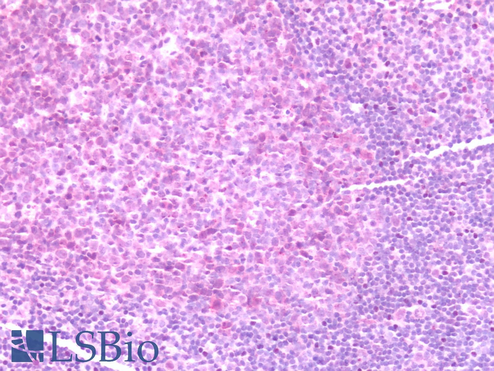 PathPlus™ Polyclonal Rabbit anti-Human CCR7 Antibody (Extracellular Domain, IHC)