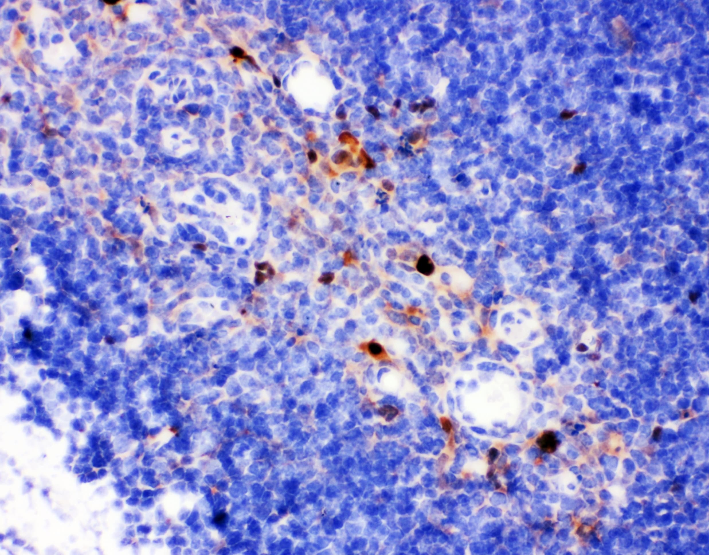 ANXA4 / Annexin IV Antibody