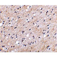 Polyclonal Rabbit anti-Human NIPSNAP1 Antibody (IHC, IF, WB)