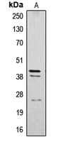 Polyclonal Rabbit anti-Human CTSB / Cathepsin B Antibody (Internal, WB)