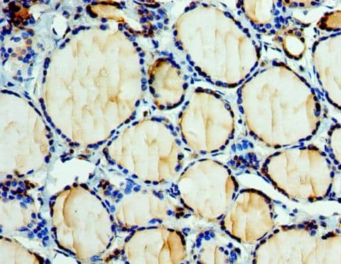 EFNA3 / Ephrin A3 Antibody (aa23-214)