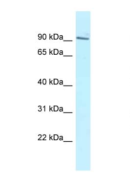 MTUS2 Antibody (aa1041-1090)
