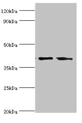 Polyclonal Rabbit anti-Human LGALS9 / Galectin 9 Antibody (aa1-240, IHC, WB)